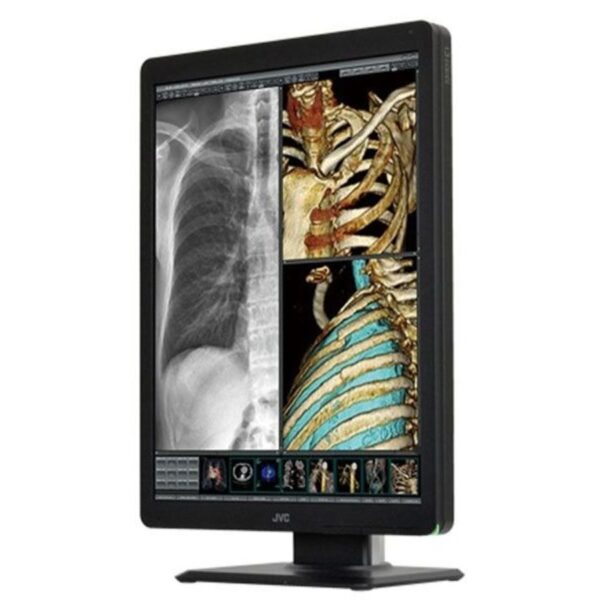 JVC CL-S200 Color LCD Medical Monitor Display