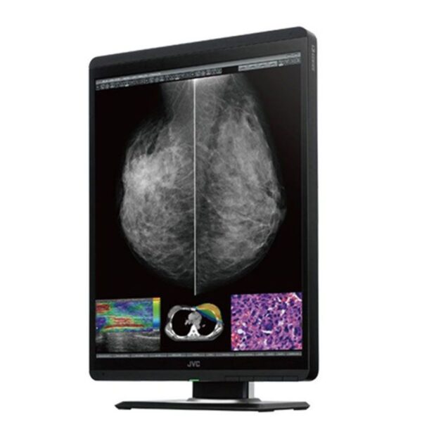 JVC Mammography CL-S500 Monitor