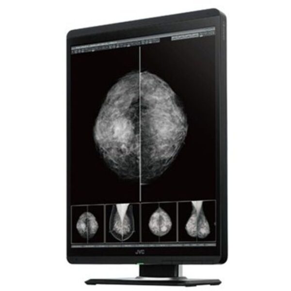 JVC Mammography MS-S500
