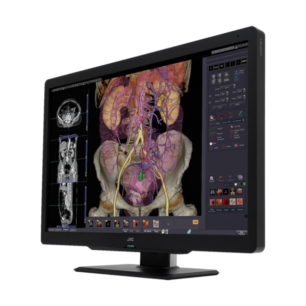 JVC CL-S600 6MP 30" COLOR MONITOR