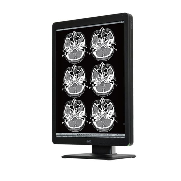 JVC MS-S200 2MP 21.3" MONOCHROME MONITOR