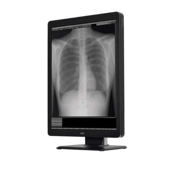 JVC MS-S300 3MP 21.3" MONOCHROME MONITOR
