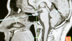 imaging equipment